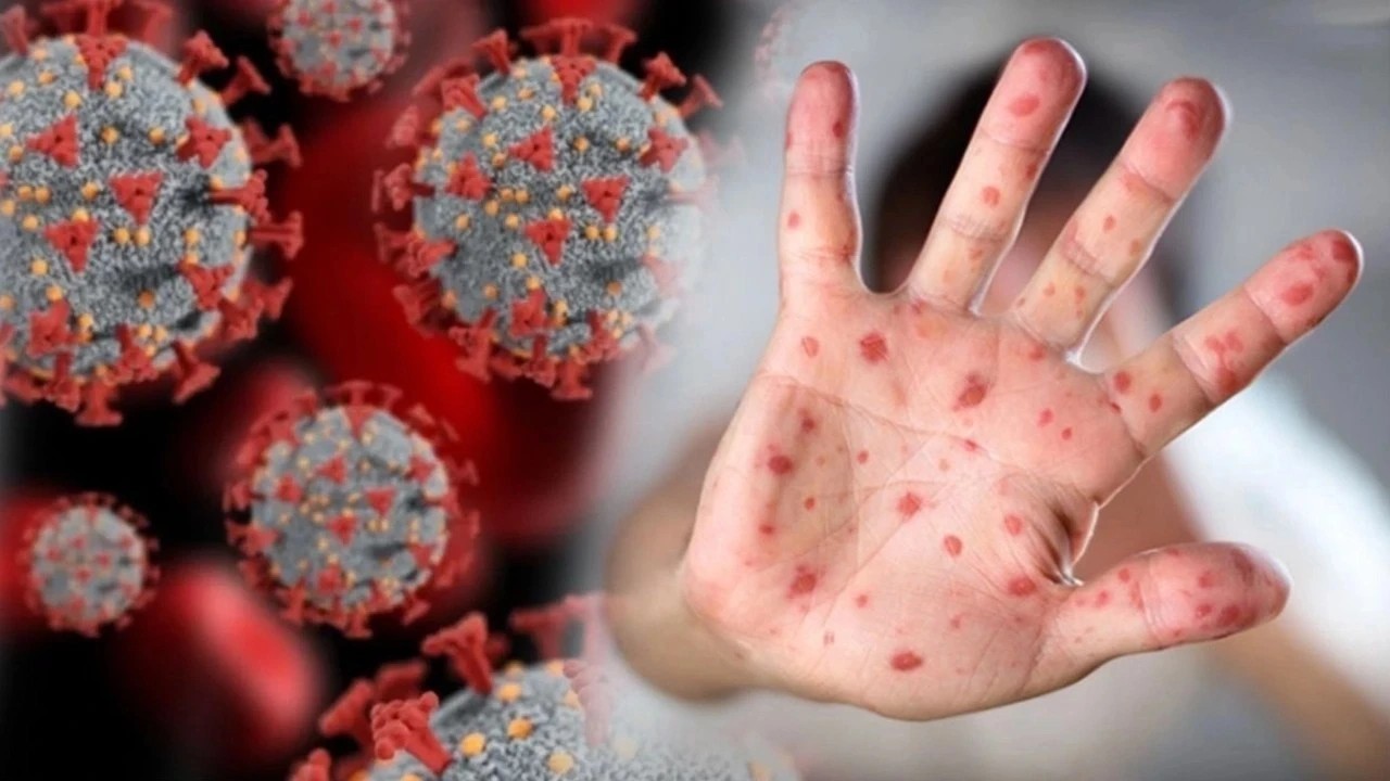 Yunanistan’da virüs alarmı!