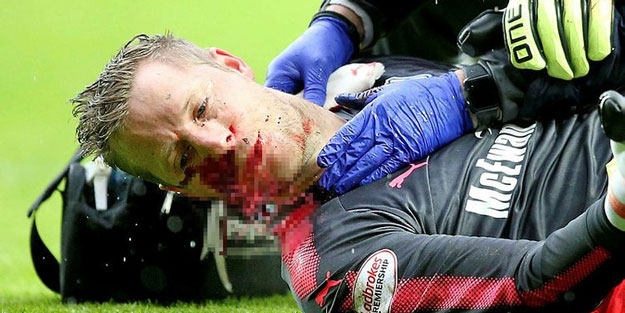 Yürekler ağza geldi! Kaleci kan içinde kaldı