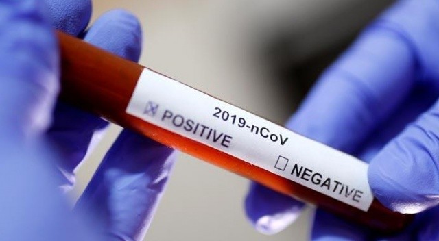 Yurt dışına çıkacak olanlar corona virüsünden nasıl korunur? Korona virüsten korunmak mümkün mü?