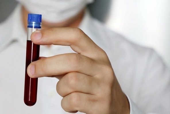 Yurt dışından gelenler nasıl rapor alacak?