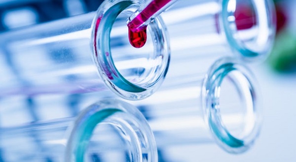 Yurt dışından gelenler raporlu mu sayılacak?