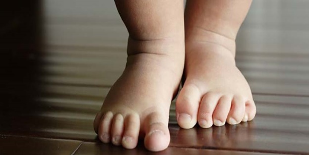 Yürüme bozukluğu nedir nasıl geçer?