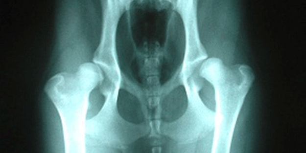 Yürüyüşünden şüphelenildi, çaldığı altınlar makatından çıktı