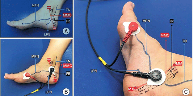 Yüz binlerce kişiye çare olacak! Dünyada ilk kez uygulanacak tedavi