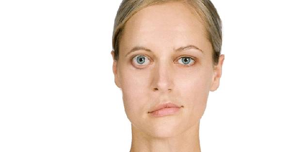 Yüz felcine karşı alınması gereken önlemler