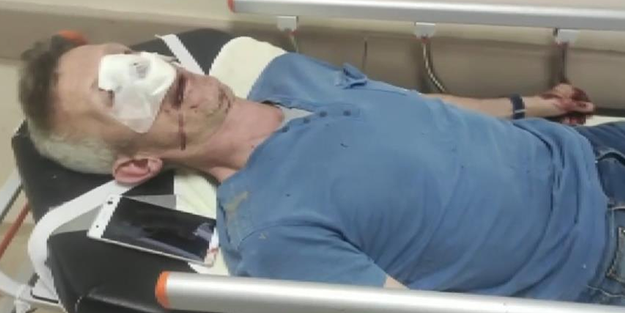 Yüzde 140'lık zama karşı çıktı, dayak yedi!