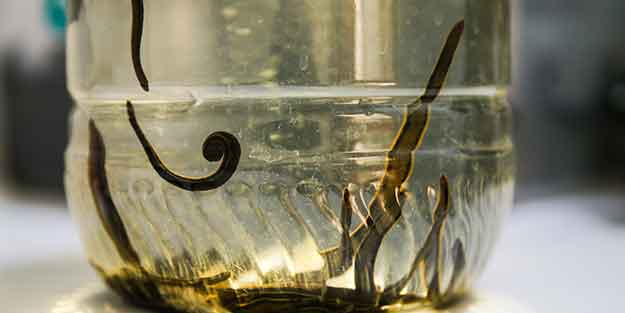 Yüzde 70'i Türkiye'de olan sülüklerin nesli tükeniyor