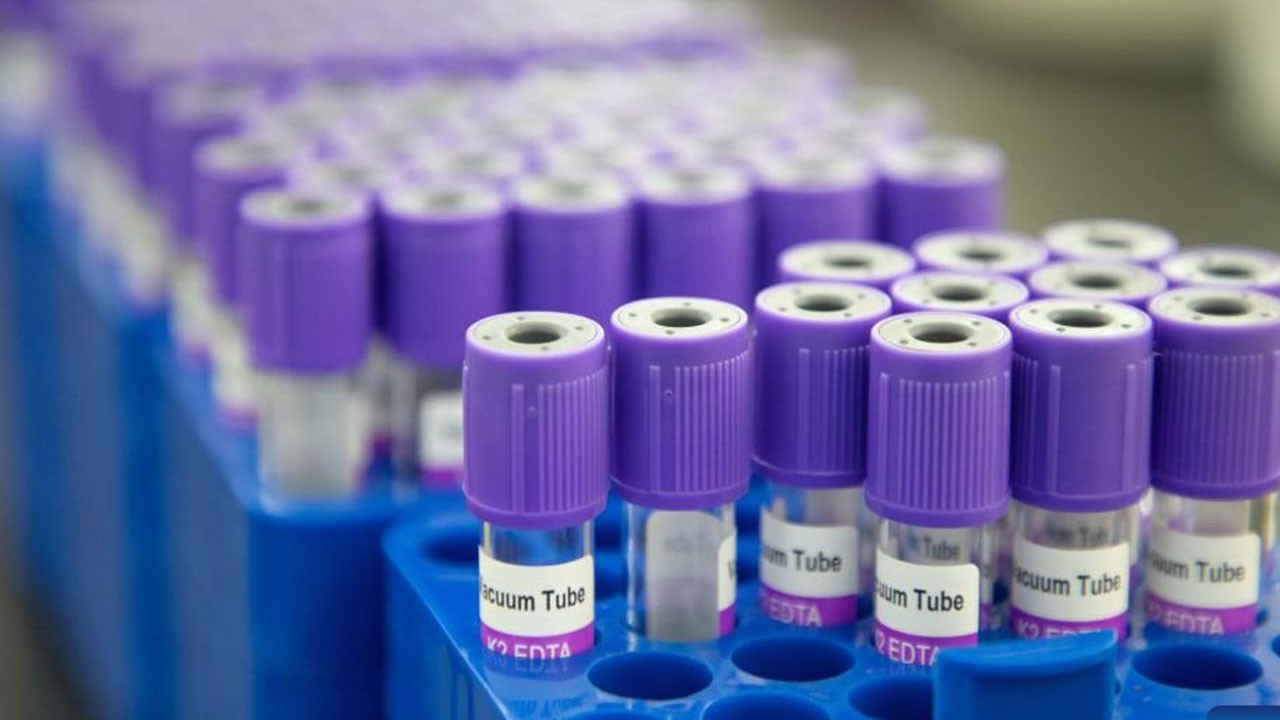Yüzde 99 doğrulukla tespit! Bu kan testi kanseri sessizce yakalıyor