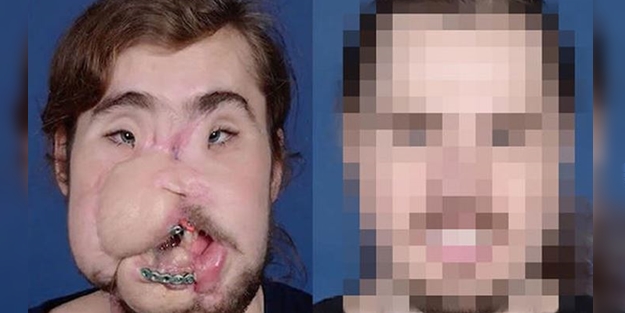 Yüzü parçalanan vatandaşın inanılmaz değişimi