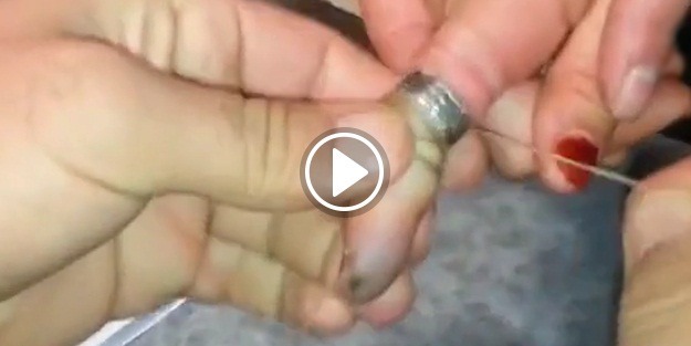 Yüzüğü çıkaramayıp itfaiye çağırdılar!