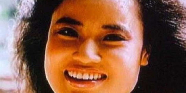 Yüzüne yemeklik yağ enjekte etti ve... - FOTO