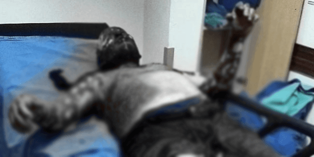 Zabıtaya kızıp kendini yakmıştı! Acı haber geldi