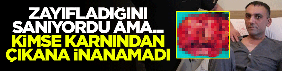 Zayıfladığını sanıyordu ama... Karnından çıkana kimse inanamadı!