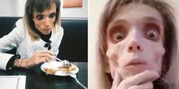 Zayıflamak isterken canınızdan olmayın!