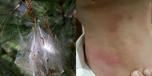 Zehir saçıyor! Sakın temas etmeyin