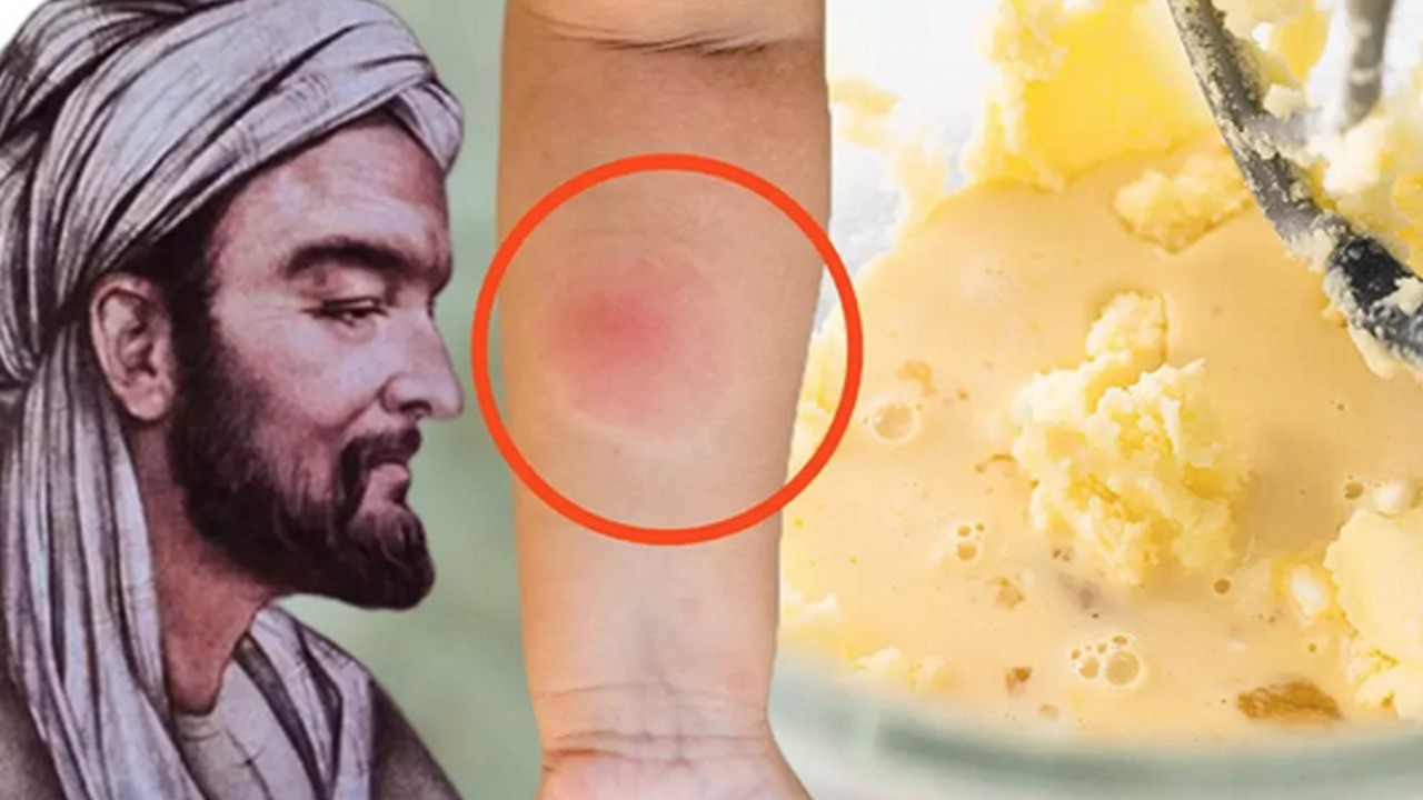 Zehirli Yılan sokmasına karşı birebir! İşte İbn-i Sina'dan asırlık şifa dolu reçete ortaya çıktı!