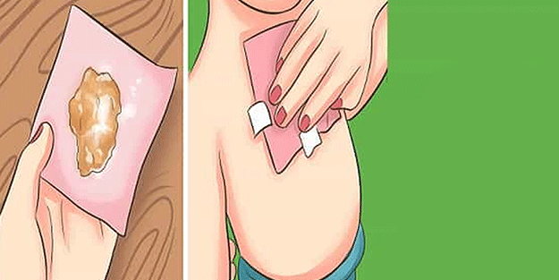 Zencefili beze sarıp göğsünüze bantlarsanız bakın ne olur! Bunu yapan şaşkınlık içinde kalıyor