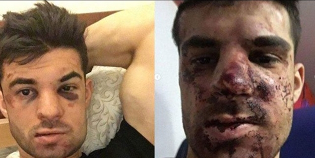 Zenitli futbolcuyu fena dövdüler!