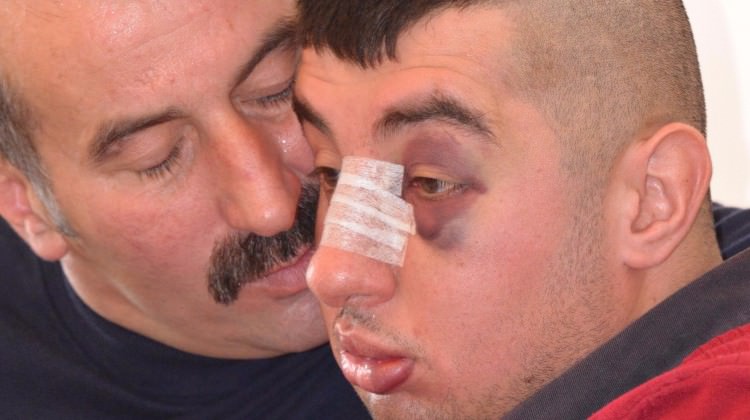 Zihinsel engelli gence aile boyu dayak!