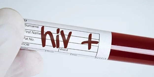 Zina ülkeyi yok ediyor! HIV dünyada azalıyor, Türkiye'de artıyor!