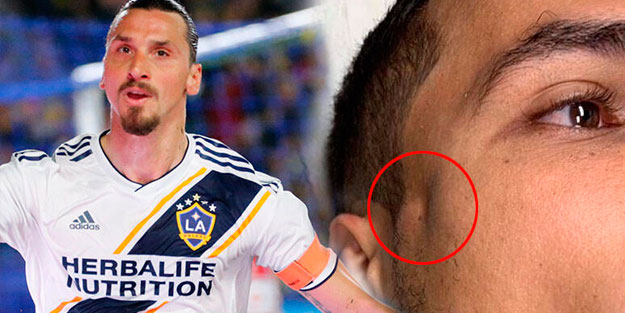 Zlatan Ibrahimovic rakibini hastanelik etti