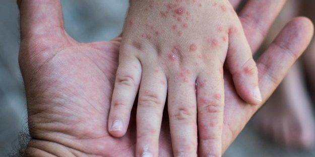 Zonaya iyi gelen 7 doğal besin