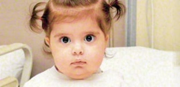 Zümra bebek büyüdükçe böbrekleri küçülecek