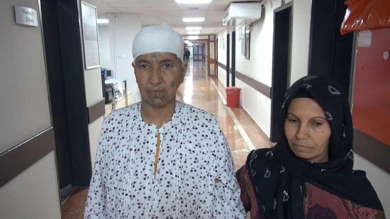 10 santimetre büyüklüğünde! Şiddetli baş ağrısı ve şişlikle hastaneye gitti