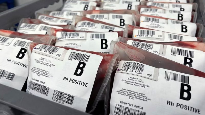B kan grubuna sahip olanlar dikkat! Bu hastalığa yakalanma riskiniz yüzde 28 daha yüksek