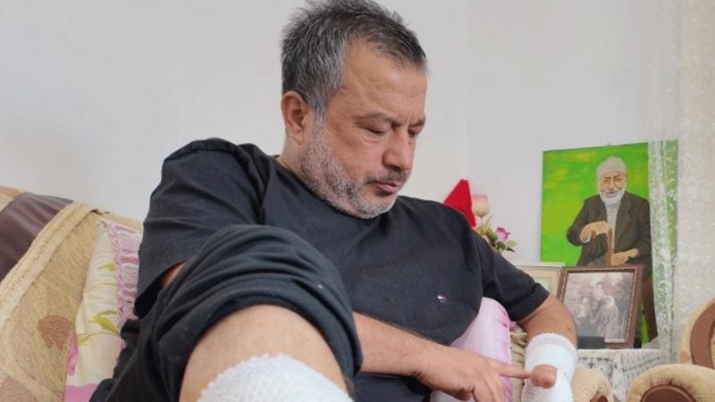 Mersin'de sahipli köpek hastanelik etti!