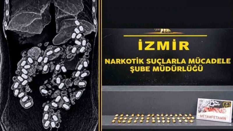 Midesinden 47 kapsül uyuşturucu çıktı!