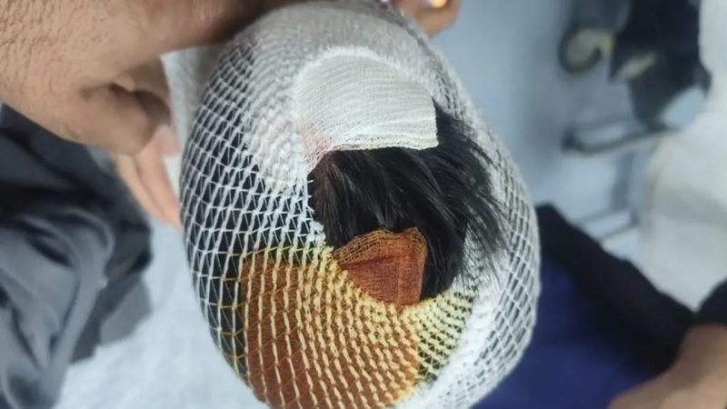 Sokak köpekleri 8 yaşındaki çocuğu hastanelik etti