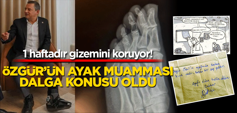1 haftadır gizemini koruyor! Özgür’ün ayak muamması dalga konusu oldu