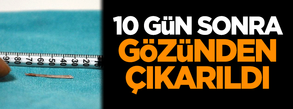 10 gün sonra gözünden çıkarıldı