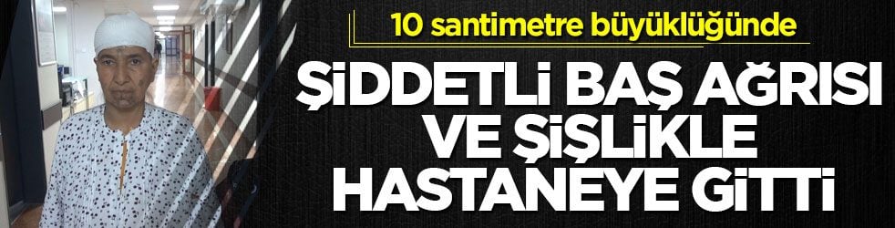 10 santimetre büyüklüğünde! Şiddetli baş ağrısı ve şişlikle hastaneye gitti