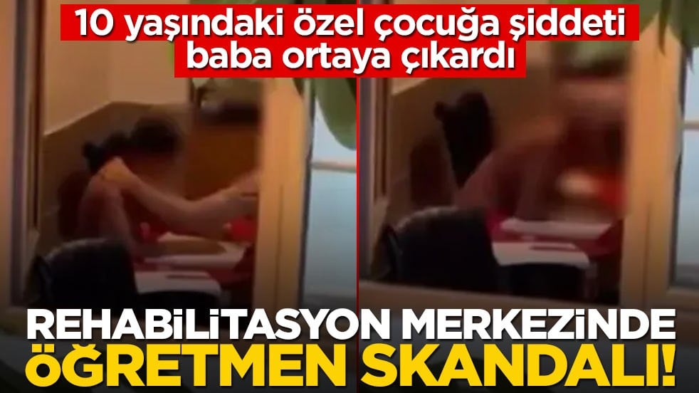 10 yaşındaki özel çocuğa şiddeti baba ortaya çıkardı! Rehabilitasyon merkezinde öğretmen skandalı!