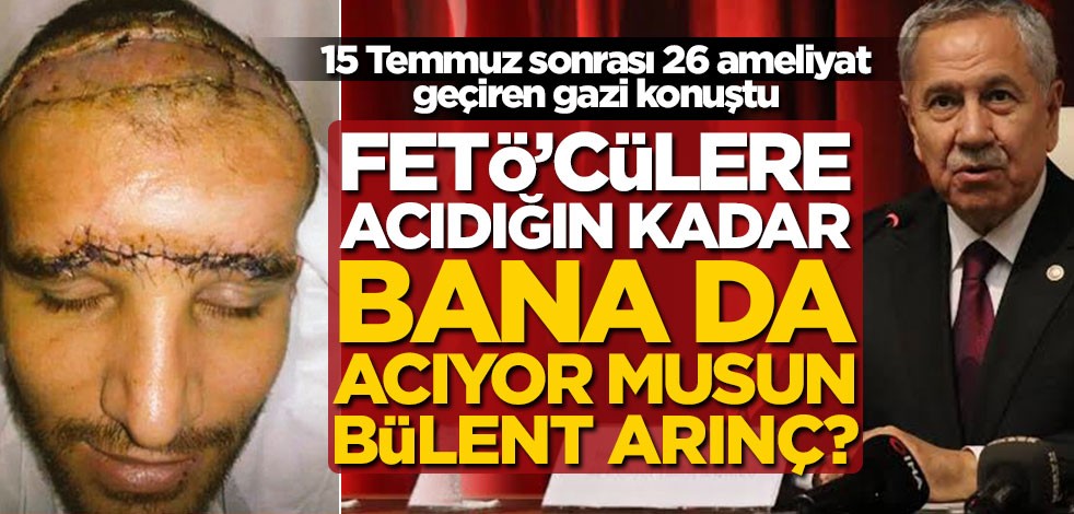 15 Temmuz sonrası 26 ameliyat geçiren gazi konuştu: FETÖ’cülere acıdığın kadar bana da acıyor musun Bülent Arınç?
