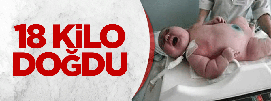 18 kilo doğdu