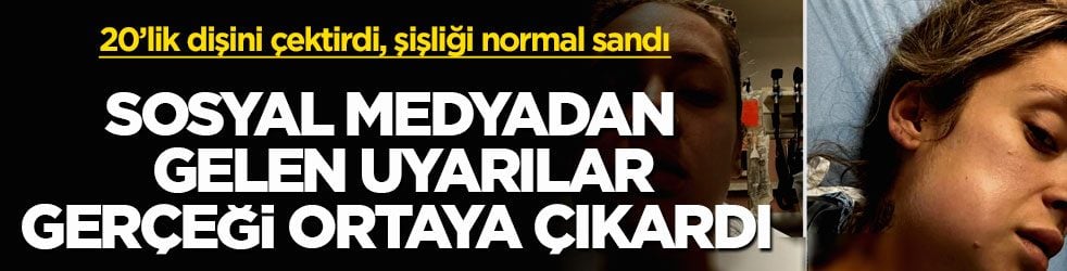 20’lik dişini çektirdi, şişliği normal sandı! Sosyal medyadan gelen uyarılar gerçeği ortaya çıkardı