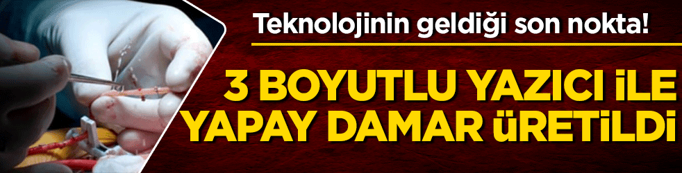 3 boyutlu biyo-yazıcı ile yapay damar üretildi