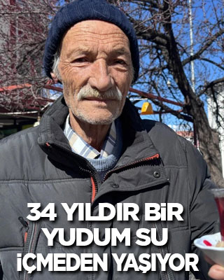 34 yıldır bir yudum su içmeden yaşıyor