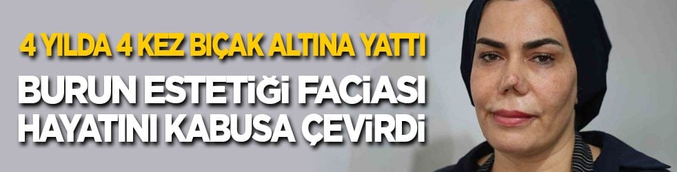 4 yılda 4 kez bıçak altına yattı! Burun estetiği faciası hayatını kabusa çevirdi