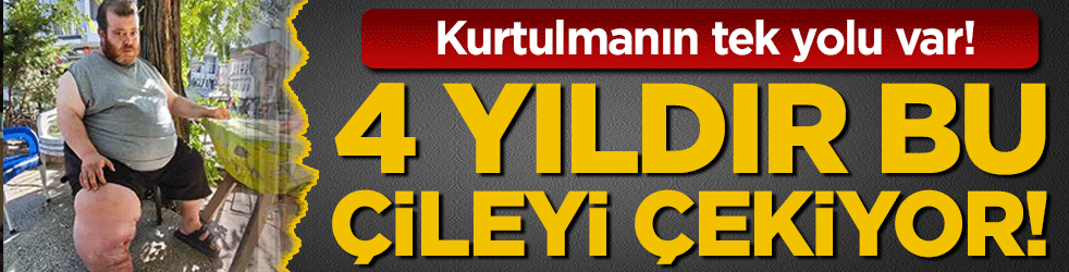 4 yıldır bu çileyi çekiyor! Kurtulmak için tek çaresi var!