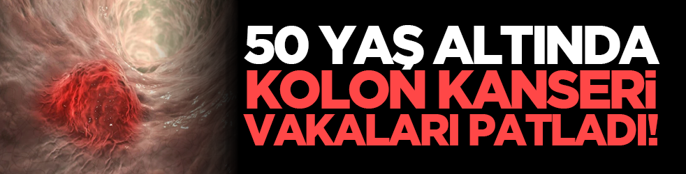 50 yaş altında kolon kanseri vakaları patladı!