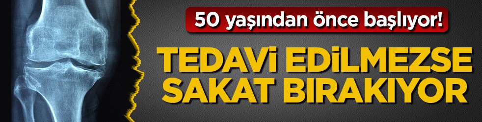 50 yaşından önce başlıyor! Tedavi edilmezse sakat bırakıyor