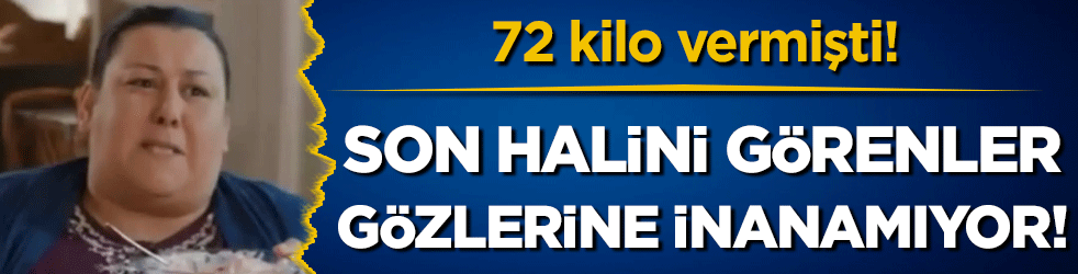72 kilo birden vermişti: Yeni halini görenler gözlerine inanamadı!