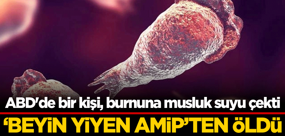 ABD'de bir kişi, burnuna musluk suyu çekti! 'Beyin yiyen amip'ten öldü