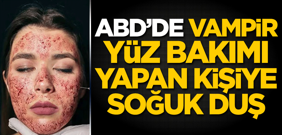 ABD'de vampir yüz bakımı yapan kişiye soğuk duş
