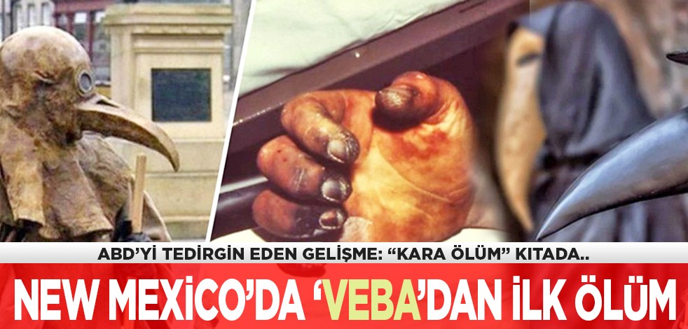 ABD’yi tedirgin eden gelişme: "Kara ölüm" kıtada: New Mexico’da ‘veba’dan ilk ölüm