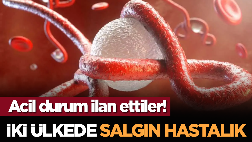 Acil durum ilan ettiler! İki ülkede salgın hastalık